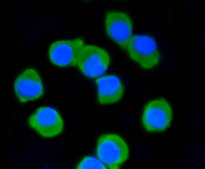 ICC staining of PSD95 in N2A cells (green). Formalin fixed cells were permeabilized with 0.1% Triton X-100 in TBS for 10 minutes at room temperature and blocked with 1% Blocker BSA for 15 minutes at room temperature. Cells were probed with the primary antibody (ET1602-20, 1/50) for 1 hour at room temperature, washed with PBS. Alexa Fluor®488 Goat anti-Rabbit IgG was used as the secondary antibody at 1/1,000 dilution. The nuclear counter stain is DAPI (blue).