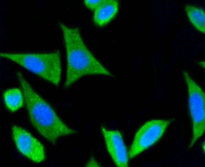 ICC staining of PSD95 in SH-SY5Y cells (green). Formalin fixed cells were permeabilized with 0.1% Triton X-100 in TBS for 10 minutes at room temperature and blocked with 1% Blocker BSA for 15 minutes at room temperature. Cells were probed with the primary antibody (ET1602-20, 1/50) for 1 hour at room temperature, washed with PBS. Alexa Fluor®488 Goat anti-Rabbit IgG was used as the secondary antibody at 1/1,000 dilution. The nuclear counter stain is DAPI (blue).