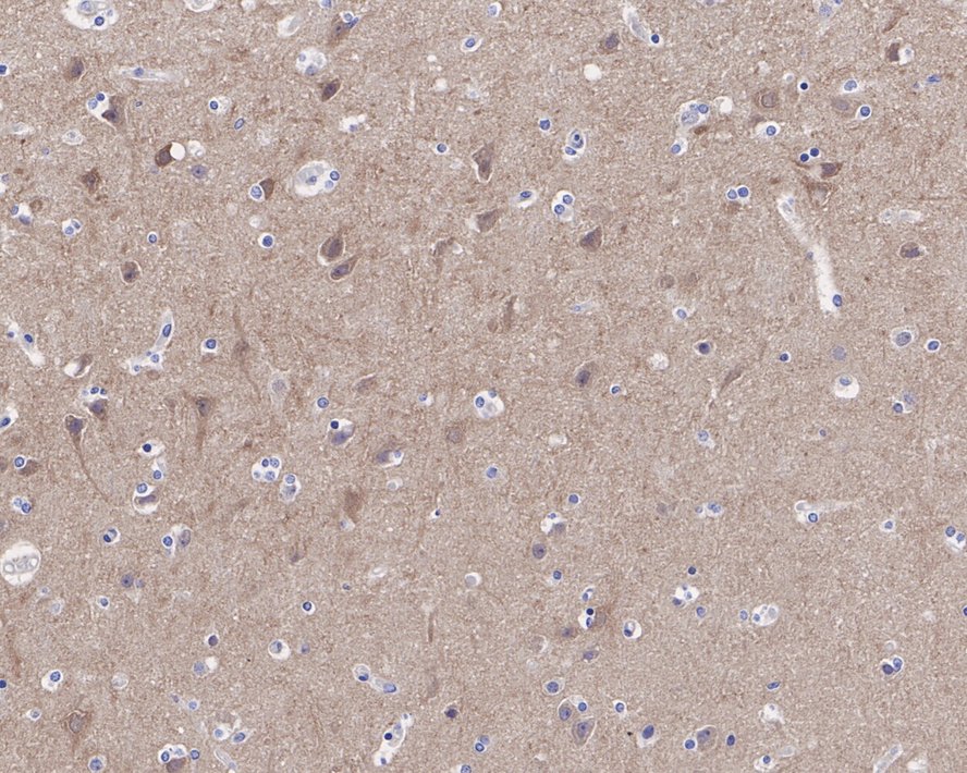 Immunohistochemical analysis of paraffin-embedded rat brain tissue using anti-PSD95 antibody. The section was pre-treated using heat mediated antigen retrieval with Tris-EDTA buffer (pH 8.0-8.4) for 20 minutes.The tissues were blocked in 5% BSA for 30 minutes at room temperature, washed with ddH2O and PBS, and then probed with the primary antibody (ET1602-20, 1/200) for 30 minutes at room temperature. The detection was performed using an HRP conjugated compact polymer system. DAB was used as the chromogen. Tissues were counterstained with hematoxylin and mounted with DPX.
