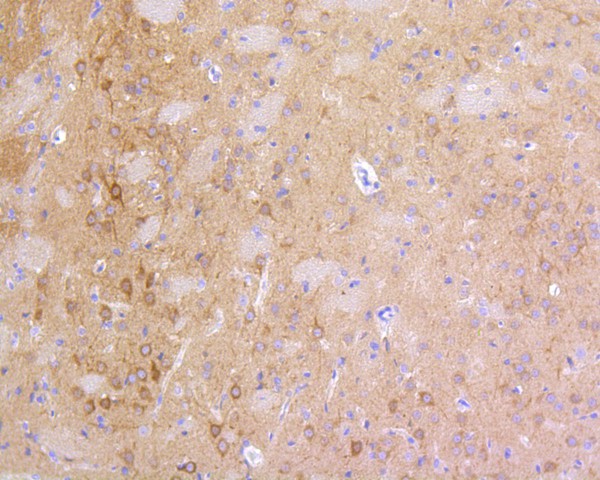 Immunohistochemical analysis of paraffin-embedded mouse cerebullum tissue using anti-PSD95 antibody. The section was pre-treated using heat mediated antigen retrieval with Tris-EDTA buffer (pH 8.0-8.4) for 20 minutes.The tissues were blocked in 5% BSA for 30 minutes at room temperature, washed with ddH2O and PBS, and then probed with the primary antibody (ET1602-20, 1/200) for 30 minutes at room temperature. The detection was performed using an HRP conjugated compact polymer system. DAB was used as the chromogen. Tissues were counterstained with hematoxylin and mounted with DPX.