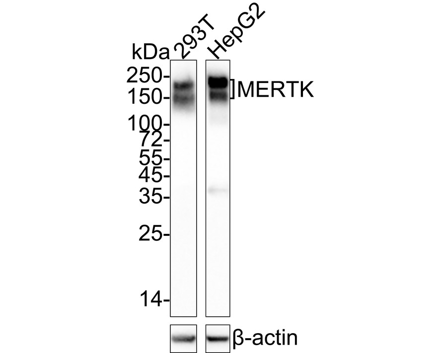 Western blot analysis of MERTK on 293T cell lysates with Rabbit anti-MERTK antibody (ET1602-21) at 1/500 dilution.<br />
<br />
Lysates/proteins at 10 µg/Lane.<br />
<br />
Predicted band size: 110 kDa<br />
Observed band size: 180 kDa<br />
<br />
Exposure time: 2 minutes;<br />
<br />
6% SDS-PAGE gel.<br />
<br />
Proteins were transferred to a PVDF membrane and blocked with 5% NFDM/TBST for 1 hour at room temperature. The primary antibody (ET1602-21) at 1/500 dilution was used in 5% NFDM/TBST at room temperature for 2 hours. Goat Anti-Rabbit IgG - HRP Secondary Antibody (HA1001) at 1:300,000 dilution was used for 1 hour at room temperature.