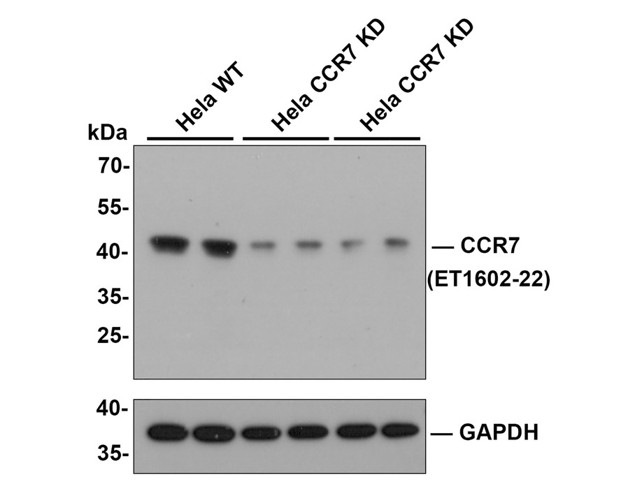 All lanes: Western blot analysis of CCR7 with anti-CCR7 antibody  (ET1602-22) at 1:5,000 dilution.<br />
Lane 1/2: Wild-type Hela whole cell lysate (10 µg).<br />
Lane 3/4: CCR7 fragment 1 knockdown Hela whole cell lysate (10 µg).<br />
Lane 5/6: CCR7 fragment 2 knockdown Hela whole cell lysate (10 µg).<br />
<br />
ET1602-22 was shown to specifically react with CCR7 in wild-type Hela cells. Weakened  was observed when CCR7 knockdown sample was tested. Wild-type and CCR7 knockdown samples were subjected to SDS-PAGE. Proteins were transferred to a PVDF membrane and blocked with 5% NFDM in TBST for 1 hour at room temperature. The primary antibody (ET1602-22, 1/500) and Loading control antibody (Rabbit anti-GAPDH, ET1601-4, 1/10,000) was used in 5% BSA at room temperature for 2 hours. Goat Anti-Rabbit IgG-HRP Secondary Antibody (HA1001) at 1:200,000 dilution was used for 1 hour at room temperature.