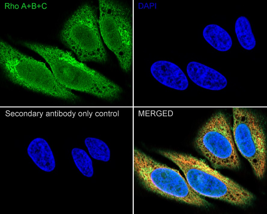 ICC staining of Rho A+B+C in AGS cells (green). Formalin fixed cells were permeabilized with 0.1% Triton X-100 in TBS for 10 minutes at room temperature and blocked with 1% Blocker BSA for 15 minutes at room temperature. Cells were probed with the primary antibody (ET1602-23, 1/50) for 1 hour at room temperature, washed with PBS. Alexa Fluor®488 Goat anti-Rabbit IgG was used as the secondary antibody at 1/1,000 dilution. The nuclear counter stain is DAPI (blue).