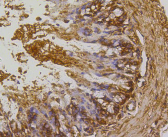 Immunohistochemical analysis of paraffin-embedded mouse colon tissue using anti-Rho A+B+C antibody. The section was pre-treated using heat mediated antigen retrieval with Tris-EDTA buffer (pH 8.0-8.4) for 20 minutes.The tissues were blocked in 5% BSA for 30 minutes at room temperature, washed with ddH2O and PBS, and then probed with the primary antibody (ET1602-23, 1/50) for 30 minutes at room temperature. The detection was performed using an HRP conjugated compact polymer system. DAB was used as the chromogen. Tissues were counterstained with hematoxylin and mounted with DPX.