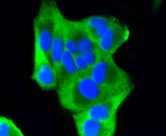 ICC staining of PUMA in SKOV-3 cells (green). Formalin fixed cells were permeabilized with 0.1% Triton X-100 in TBS for 10 minutes at room temperature and blocked with 1% Blocker BSA for 15 minutes at room temperature. Cells were probed with the primary antibody (ET1602-24, 1/50) for 1 hour at room temperature, washed with PBS. Alexa Fluor®488 Goat anti-Rabbit IgG was used as the secondary antibody at 1/1,000 dilution. The nuclear counter stain is DAPI (blue).