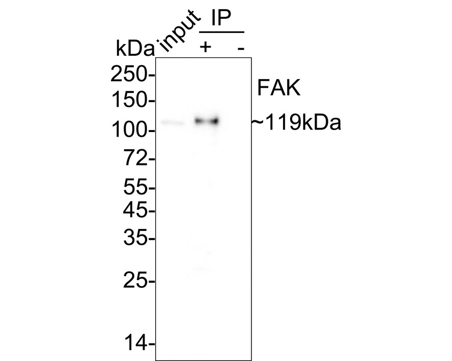 ICC staining of FAK in SH-SY5Y cells (green). Formalin fixed cells were permeabilized with 0.1% Triton X-100 in TBS for 10 minutes at room temperature and blocked with 1% Blocker BSA for 15 minutes at room temperature. Cells were probed with the primary antibody (ET1602-25, 1/50) for 1 hour at room temperature, washed with PBS. Alexa Fluor®488 Goat anti-Rabbit IgG was used as the secondary antibody at 1/1,000 dilution. The nuclear counter stain is DAPI (blue).