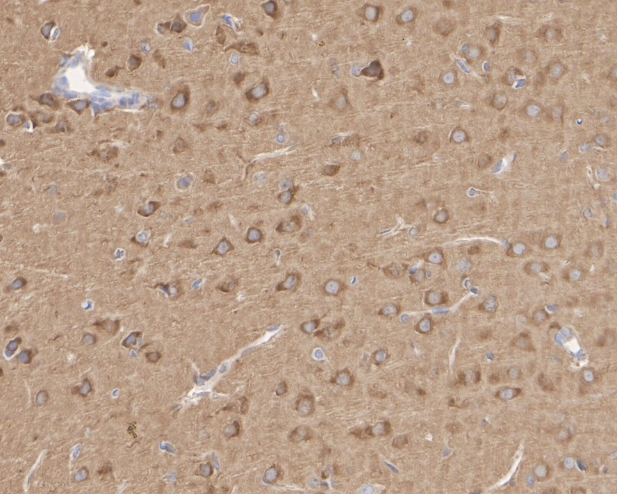 Immunohistochemical analysis of paraffin-embedded mouse kidney tissue using anti-FAK antibody. The section was pre-treated using heat mediated antigen retrieval with Tris-EDTA buffer (pH 8.0-8.4) for 20 minutes.The tissues were blocked in 5% BSA for 30 minutes at room temperature, washed with ddH2O and PBS, and then probed with the primary antibody (ET1602-25, 1/200) for 30 minutes at room temperature. The detection was performed using an HRP conjugated compact polymer system. DAB was used as the chromogen. Tissues were counterstained with hematoxylin and mounted with DPX.