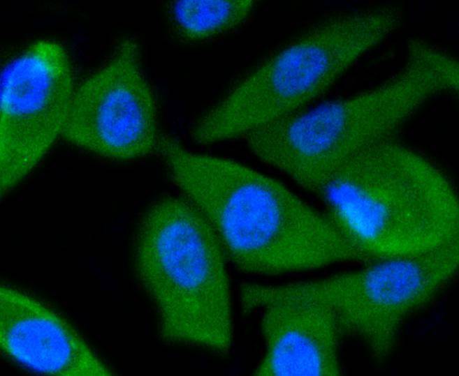 ICC staining of PI 3 Kinase p55 gamma in PC-3M cells (green). Formalin fixed cells were permeabilized with 0.1% Triton X-100 in TBS for 10 minutes at room temperature and blocked with 1% Blocker BSA for 15 minutes at room temperature. Cells were probed with the primary antibody (ET1602-27, 1/50) for 1 hour at room temperature, washed with PBS. Alexa Fluor®488 Goat anti-Rabbit IgG was used as the secondary antibody at 1/1,000 dilution. The nuclear counter stain is DAPI (blue).