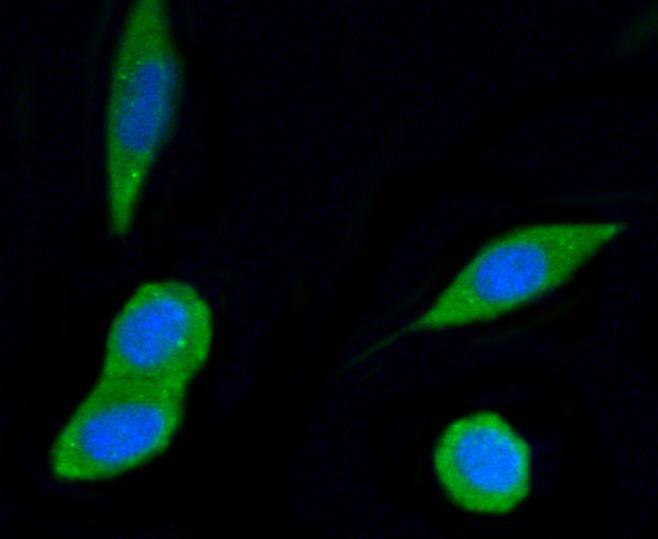 ICC staining of PI 3 Kinase p55 gamma in SH-SY5Y cells (green). Formalin fixed cells were permeabilized with 0.1% Triton X-100 in TBS for 10 minutes at room temperature and blocked with 1% Blocker BSA for 15 minutes at room temperature. Cells were probed with the primary antibody (ET1602-27, 1/50) for 1 hour at room temperature, washed with PBS. Alexa Fluor®488 Goat anti-Rabbit IgG was used as the secondary antibody at 1/1,000 dilution. The nuclear counter stain is DAPI (blue).