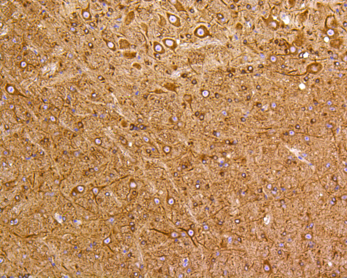 Immunohistochemical analysis of paraffin-embedded mouse brain tissue using anti-PI 3 Kinase p55 gamma antibody. The section was pre-treated using heat mediated antigen retrieval with Tris-EDTA buffer (pH 8.0-8.4) for 20 minutes.The tissues were blocked in 5% BSA for 30 minutes at room temperature, washed with ddH2O and PBS, and then probed with the primary antibody (ET1602-27, 1/200) for 30 minutes at room temperature. The detection was performed using an HRP conjugated compact polymer system. DAB was used as the chromogen. Tissues were counterstained with hematoxylin and mounted with DPX.