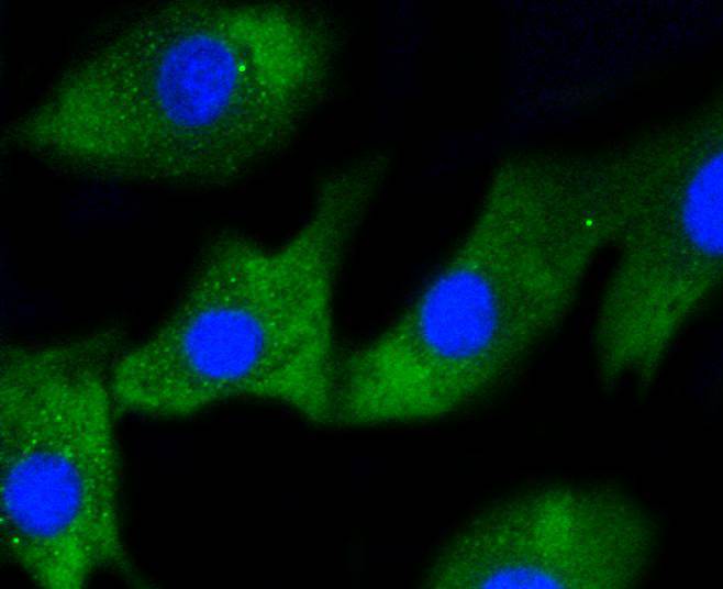 ICC staining of IRF1 in NIH/3T3 cells (green). Formalin fixed cells were permeabilized with 0.1% Triton X-100 in TBS for 10 minutes at room temperature and blocked with 1% Blocker BSA for 15 minutes at room temperature. Cells were probed with the primary antibody (ET1602-28, 1/50) for 1 hour at room temperature, washed with PBS. Alexa Fluor®488 Goat anti-Rabbit IgG was used as the secondary antibody at 1/1,000 dilution. The nuclear counter stain is DAPI (blue).