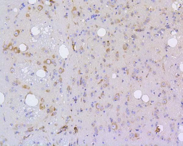 Immunohistochemical analysis of paraffin-embedded mouse brain tissue using anti-IRF1 antibody. The section was pre-treated using heat mediated antigen retrieval with Tris-EDTA buffer (pH 8.0-8.4) for 20 minutes.The tissues were blocked in 5% BSA for 30 minutes at room temperature, washed with ddH2O and PBS, and then probed with the primary antibody (ET1602-28, 1/50) for 30 minutes at room temperature. The detection was performed using an HRP conjugated compact polymer system. DAB was used as the chromogen. Tissues were counterstained with hematoxylin and mounted with DPX.