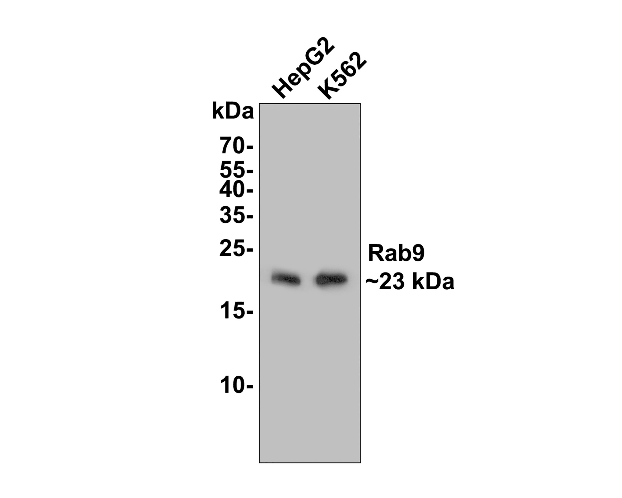 Western blot analysis of Rab9 on different lysates with Rabbit anti-Rab9 antibody (ET1602-29) at 1/500 dilution.<br />
<br />
Lane 1: HepG2 cell lysate<br />
Lane 2: K562 cell lysate<br />
<br />
Lysates/proteins at 10 µg/Lane.<br />
<br />
Predicted band size: 23 kDa<br />
Observed band size: 23 kDa<br />
<br />
Exposure time: 2 minutes;<br />
<br />
15% SDS-PAGE gel.<br />
<br />
Proteins were transferred to a PVDF membrane and blocked with 5% NFDM/TBST for 1 hour at room temperature. The primary antibody (ET1602-29) at 1/500 dilution was used in 5% NFDM/TBST at room temperature for 2 hours. Goat Anti-Rabbit IgG - HRP Secondary Antibody (HA1001) at 1:300,000 dilution was used for 1 hour at room temperature.