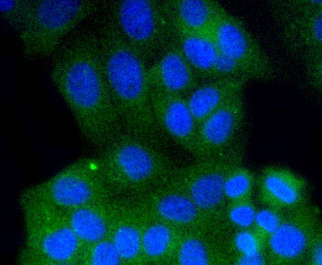 ICC staining of Rab9 in HepG2 cells (green). Formalin fixed cells were permeabilized with 0.1% Triton X-100 in TBS for 10 minutes at room temperature and blocked with 1% Blocker BSA for 15 minutes at room temperature. Cells were probed with the primary antibody (ET1602-29, 1/50) for 1 hour at room temperature, washed with PBS. Alexa Fluor®488 Goat anti-Rabbit IgG was used as the secondary antibody at 1/1,000 dilution. The nuclear counter stain is DAPI (blue).