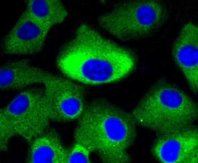 ICC staining of MEK1/2 in A549 cells (green). Formalin fixed cells were permeabilized with 0.1% Triton X-100 in TBS for 10 minutes at room temperature and blocked with 1% Blocker BSA for 15 minutes at room temperature. Cells were probed with the primary antibody (ET1602-3, 1/50) for 1 hour at room temperature, washed with PBS. Alexa Fluor®488 Goat anti-Rabbit IgG was used as the secondary antibody at 1/1,000 dilution. The nuclear counter stain is DAPI (blue).