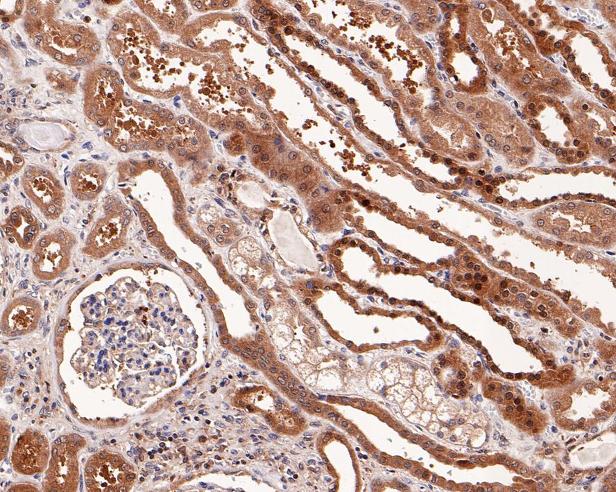 Immunohistochemical analysis of paraffin-embedded human kidney tissue with Rabbit anti-MEK1/2 antibody (ET1602-3) at 1/200 dilution.<br />
<br />
The section was pre-treated using heat mediated antigen retrieval with Tris-EDTA buffer (pH 9.0) for 20 minutes. The tissues were blocked in 1% BSA for 20 minutes at room temperature, washed with ddH2O and PBS, and then probed with the primary antibody (ET1602-3) at 1/200 dilution for 1 hour at room temperature. The detection was performed using an HRP conjugated compact polymer system. DAB was used as the chromogen. Tissues were counterstained with hematoxylin and mounted with DPX.