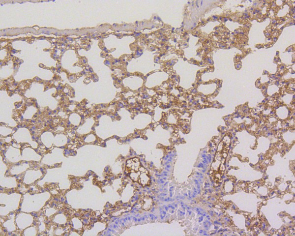 Immunohistochemical analysis of paraffin-embedded mouse lung tissue using anti-MEK1/2 antibody. The section was pre-treated using heat mediated antigen retrieval with Tris-EDTA buffer (pH 8.0-8.4) for 20 minutes.The tissues were blocked in 5% BSA for 30 minutes at room temperature, washed with ddH2O and PBS, and then probed with the primary antibody (ET1602-3, 1/200) for 30 minutes at room temperature. The detection was performed using an HRP conjugated compact polymer system. DAB was used as the chromogen. Tissues were counterstained with hematoxylin and mounted with DPX.