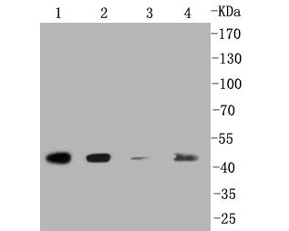 Western blot analysis of Caspase-2 on different lysates. Proteins were transferred to a PVDF membrane and blocked with 5% BSA in PBS for 1 hour at room temperature. The primary antibody (ET1602-30, 1/500) was used in 5% BSA at room temperature for 2 hours. Goat Anti-Rabbit IgG - HRP Secondary Antibody (HA1001) at 1:5,000 dilution was used for 1 hour at room temperature.<br />
Positive control: <br />
Lane 2: 293 cell lysate<br />
Lane 2: Jurkat cell lysate<br />
Lane 2: HUVEC cell lysate<br />
Lane 1: human lung carcinoma tissue lysate