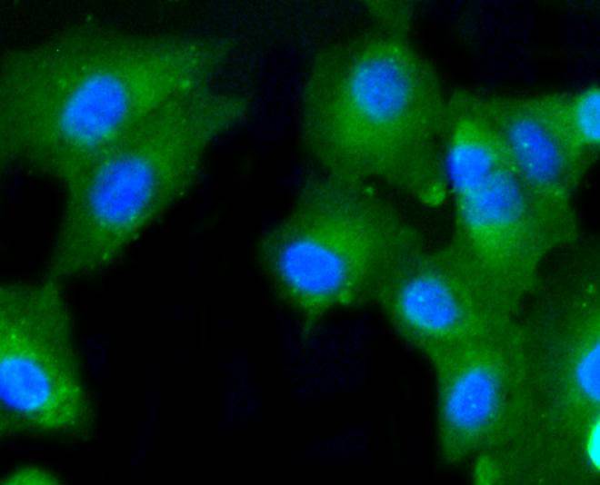 ICC staining of Caspase-2 in A549 cells (green). Formalin fixed cells were permeabilized with 0.1% Triton X-100 in TBS for 10 minutes at room temperature and blocked with 1% Blocker BSA for 15 minutes at room temperature. Cells were probed with the primary antibody (ET1602-30, 1/50) for 1 hour at room temperature, washed with PBS. Alexa Fluor®488 Goat anti-Rabbit IgG was used as the secondary antibody at 1/1,000 dilution. The nuclear counter stain is DAPI (blue).