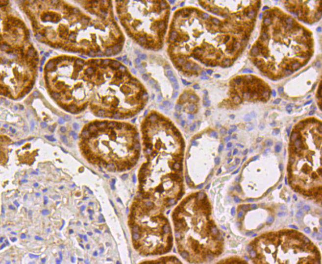 Immunohistochemical analysis of paraffin-embedded human kidney tissue using anti-Caspase-2 antibody. The section was pre-treated using heat mediated antigen retrieval with Tris-EDTA buffer (pH 8.0-8.4) for 20 minutes.The tissues were blocked in 5% BSA for 30 minutes at room temperature, washed with ddH2O and PBS, and then probed with the primary antibody (ET1602-30, 1/50) for 30 minutes at room temperature. The detection was performed using an HRP conjugated compact polymer system. DAB was used as the chromogen. Tissues were counterstained with hematoxylin and mounted with DPX.