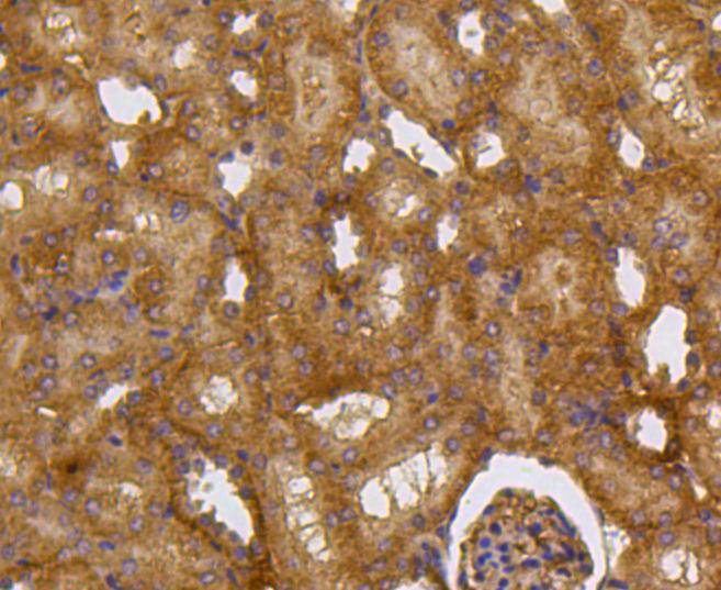 Immunohistochemical analysis of paraffin-embedded mouse kidney tissue using anti-Caspase-2 antibody. The section was pre-treated using heat mediated antigen retrieval with Tris-EDTA buffer (pH 8.0-8.4) for 20 minutes.The tissues were blocked in 5% BSA for 30 minutes at room temperature, washed with ddH2O and PBS, and then probed with the primary antibody (ET1602-30, 1/50) for 30 minutes at room temperature. The detection was performed using an HRP conjugated compact polymer system. DAB was used as the chromogen. Tissues were counterstained with hematoxylin and mounted with DPX.