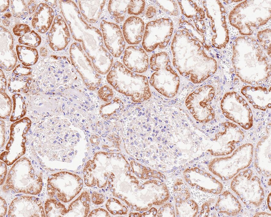 Immunohistochemical analysis of paraffin-embedded human kidney tissue with Rabbit anti-Prohibitin antibody (ET1602-31) at 1/1,000 dilution.<br />
<br />
The section was pre-treated using heat mediated antigen retrieval with Tris-EDTA buffer (pH 9.0) for 20 minutes. The tissues were blocked in 1% BSA for 20 minutes at room temperature, washed with ddH2O and PBS, and then probed with the primary antibody (ET1602-31) at 1/1,000 dilution for 1 hour at room temperature. The detection was performed using an HRP conjugated compact polymer system. DAB was used as the chromogen. Tissues were counterstained with hematoxylin and mounted with DPX.