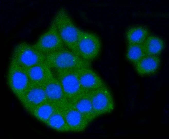 ICC staining of Scavenging Receptor SR-BI in CRC cells (green). Formalin fixed cells were permeabilized with 0.1% Triton X-100 in TBS for 10 minutes at room temperature and blocked with 1% Blocker BSA for 15 minutes at room temperature. Cells were probed with the primary antibody (ET1602-32, 1/50) for 1 hour at room temperature, washed with PBS. Alexa Fluor®488 Goat anti-Rabbit IgG was used as the secondary antibody at 1/1,000 dilution. The nuclear counter stain is DAPI (blue).
