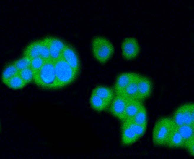 ICC staining of Scavenging Receptor SR-BI in PC-12 cells (green). Formalin fixed cells were permeabilized with 0.1% Triton X-100 in TBS for 10 minutes at room temperature and blocked with 1% Blocker BSA for 15 minutes at room temperature. Cells were probed with the primary antibody (ET1602-32, 1/50) for 1 hour at room temperature, washed with PBS. Alexa Fluor®488 Goat anti-Rabbit IgG was used as the secondary antibody at 1/1,000 dilution. The nuclear counter stain is DAPI (blue).