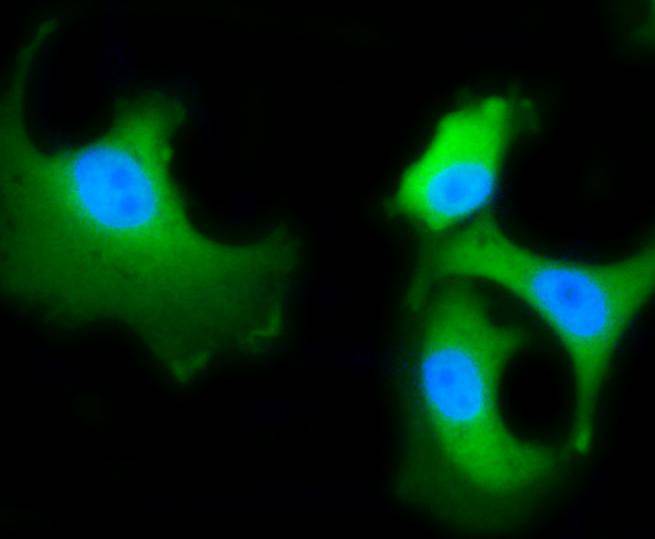 ICC staining of Hsc70 in MCF-7 cells (green). Formalin fixed cells were permeabilized with 0.1% Triton X-100 in TBS for 10 minutes at room temperature and blocked with 1% Blocker BSA for 15 minutes at room temperature. Cells were probed with the primary antibody (ET1602-33, 1/50) for 1 hour at room temperature, washed with PBS. Alexa Fluor®488 Goat anti-Rabbit IgG was used as the secondary antibody at 1/1,000 dilution. The nuclear counter stain is DAPI (blue).