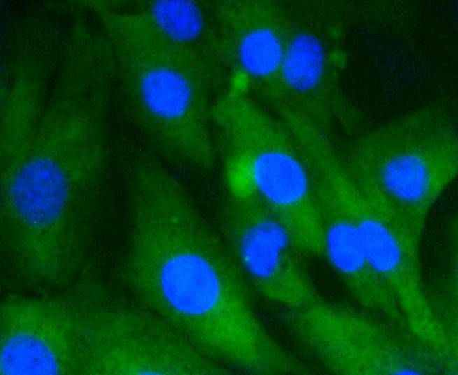 ICC staining of Hsc70 in NIH/3T3 cells (green). Formalin fixed cells were permeabilized with 0.1% Triton X-100 in TBS for 10 minutes at room temperature and blocked with 1% Blocker BSA for 15 minutes at room temperature. Cells were probed with the primary antibody (ET1602-33, 1/50) for 1 hour at room temperature, washed with PBS. Alexa Fluor®488 Goat anti-Rabbit IgG was used as the secondary antibody at 1/1,000 dilution. The nuclear counter stain is DAPI (blue).