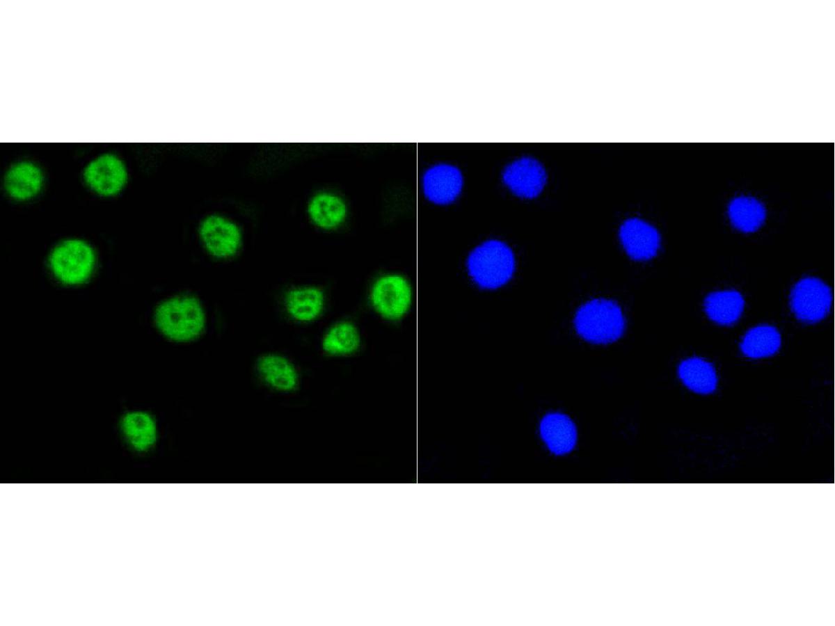ICC staining of Histone H2A(acetyl K9) in A549 cells (green). Formalin fixed cells were permeabilized with 0.1% Triton X-100 in TBS for 10 minutes at room temperature and blocked with 10% negative goat serum for 15 minutes at room temperature. Cells were probed with the primary antibody (ET1602-34, 1/50) for 1 hour at room temperature, washed with PBS. Alexa Fluor®488 conjugate-Goat anti-Rabbit IgG was used as the secondary antibody at 1/1,000 dilution. The nuclear counter stain is DAPI (blue).