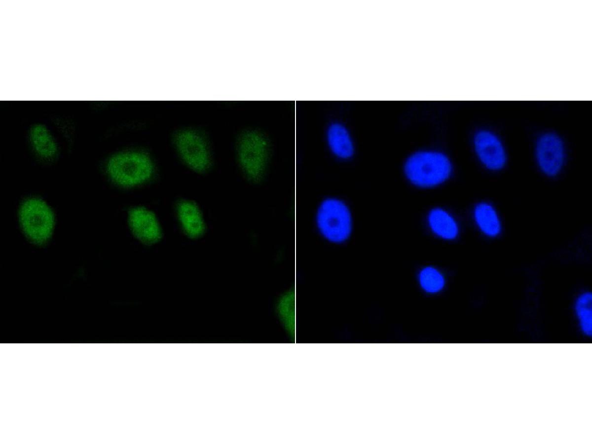 ICC staining of Histone H2A(acetyl K9) in MCF-7 cells (green). Formalin fixed cells were permeabilized with 0.1% Triton X-100 in TBS for 10 minutes at room temperature and blocked with 10% negative goat serum for 15 minutes at room temperature. Cells were probed with the primary antibody (ET1602-34, 1/50) for 1 hour at room temperature, washed with PBS. Alexa Fluor®488 conjugate-Goat anti-Rabbit IgG was used as the secondary antibody at 1/1,000 dilution. The nuclear counter stain is DAPI (blue).