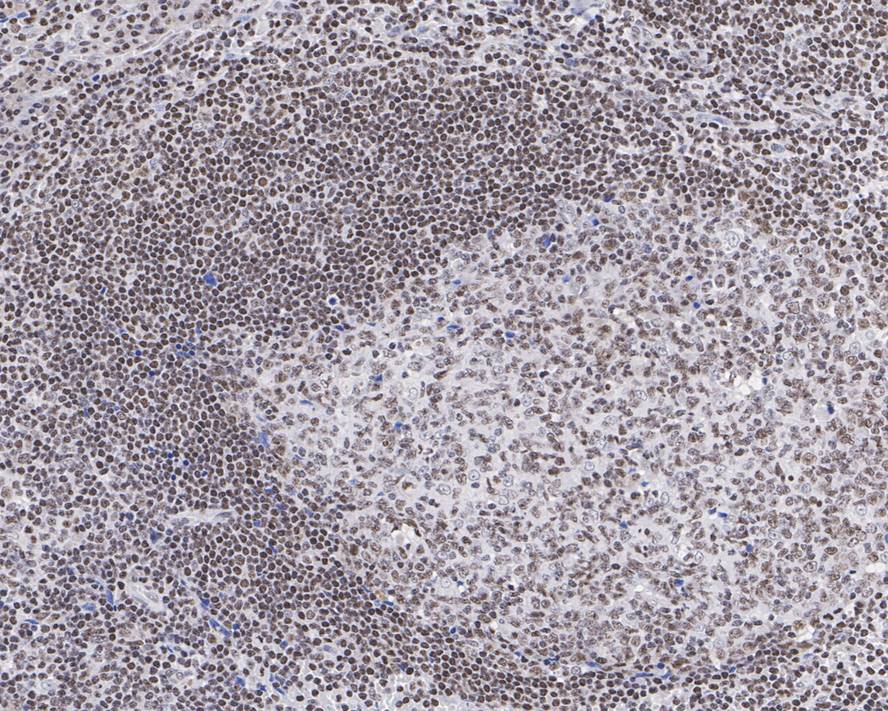 Immunohistochemical analysis of paraffin-embedded human tonsil tissue using anti-Histone H2A(acetyl K9) antibody. The section was pre-treated using heat mediated antigen retrieval with Tris-EDTA buffer (pH 9.0) for 20 minutes.The tissues were blocked in 1% BSA for 30 minutes at room temperature, washed with ddH2O and PBS, and then probed with the primary antibody (ET1602-34, 1/50) for 30 minutes at room temperature. The detection was performed using an HRP conjugated compact polymer system. DAB was used as the chromogen. Tissues were counterstained with hematoxylin and mounted with DPX.