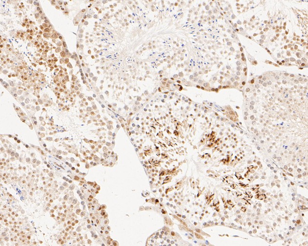 Immunohistochemical analysis of paraffin-embedded mouse testis tissue using anti-Histone H2A(acetyl K9) antibody. The section was pre-treated using heat mediated antigen retrieval with Tris-EDTA buffer (pH 9.0) for 20 minutes.The tissues were blocked in 1% BSA for 30 minutes at room temperature, washed with ddH2O and PBS, and then probed with the primary antibody (ET1602-34, 1/50) for 30 minutes at room temperature. The detection was performed using an HRP conjugated compact polymer system. DAB was used as the chromogen. Tissues were counterstained with hematoxylin and mounted with DPX.