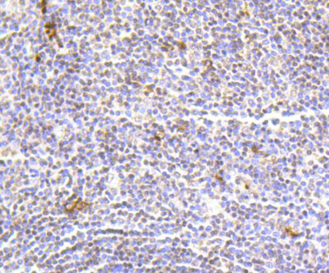 Immunohistochemical analysis of paraffin-embedded human tonsil tissue using anti-Histone H2A(hydroxyl Y39) antibody. The section was pre-treated using heat mediated antigen retrieval with Tris-EDTA buffer (pH 9.0) for 20 minutes.The tissues were blocked in 1% BSA for 30 minutes at room temperature, washed with ddH2O and PBS, and then probed with the primary antibody (ET1602-35, 1/50) for 30 minutes at room temperature. The detection was performed using an HRP conjugated compact polymer system. DAB was used as the chromogen. Tissues were counterstained with hematoxylin and mounted with DPX.