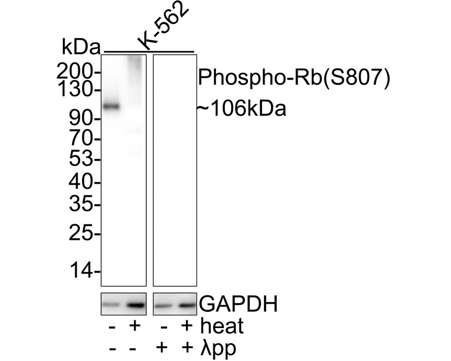 A549 hücre lizatları üzerinde Phospho-Rb(S807)'nin Western blot analizi.  Proteinler bir PVDF membranına aktarıldı ve oda sıcaklığında 1 saat boyunca PBS içinde %5 BSA ile bloke edildi.  Birincil antikor (ET1602-36, 1/1.000), oda sıcaklığında 2 saat boyunca %5 BSA içinde kullanıldı.  Keçi Anti-Rabbit IgG - HRP Sekonder Antikoru (HA1001) 1:5,000 seyreltmede oda sıcaklığında 1 saat kullanıldı.