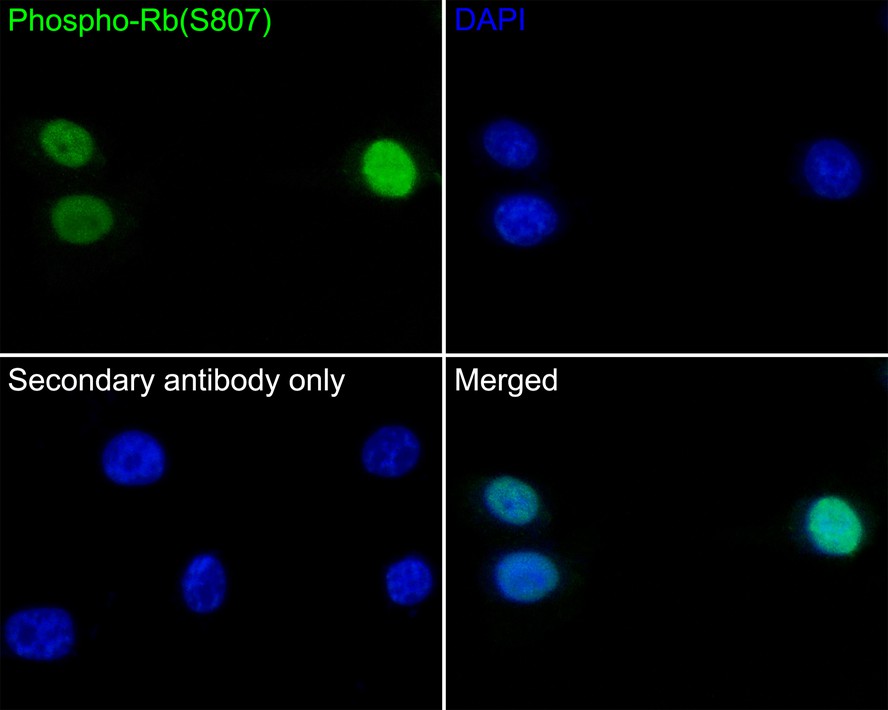 Immunocytochemistry analysis of A549 cells labeling Phospho-Rb(S807) with Rabbit anti-Phospho-Rb(S807) antibody (ET1602-36) at 1/50 dilution.<br />
<br />
Cells were fixed in 4% paraformaldehyde for 10 minutes at 37 ℃, permeabilized with 0.05% Triton X-100 in PBS for 20 minutes, and then blocked with 2% negative goat serum for 30 minutes at room temperature. Cells were then incubated with Rabbit anti-Phospho-Rb(S807) antibody (ET1602-36) at 1/50 dilution in 2% negative goat serum overnight at 4 ℃. Goat Anti-Rabbit IgG H&L (iFluor™ 488, HA1121) was used as the secondary antibody at 1/1,000 dilution. PBS instead of the primary antibody was used as the secondary antibody only control. Nuclear DNA was labelled in blue with DAPI.