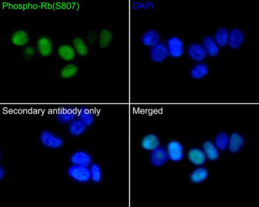 ICC staining of Phospho-Rb(S807) in MCF-7 cells (green). Formalin fixed cells were permeabilized with 0.1% Triton X-100 in TBS for 10 minutes at room temperature and blocked with 1% Blocker BSA for 15 minutes at room temperature. Cells were probed with the primary antibody (ET1602-36, 1/50) for 1 hour at room temperature, washed with PBS. Alexa Fluor®488 Goat anti-Rabbit IgG was used as the secondary antibody at 1/1,000 dilution. The nuclear counter stain is DAPI (blue).