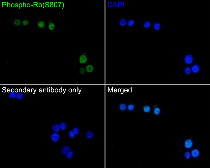 Immunocytochemistry analysis of CRC cells labeling Phospho-Rb(S807) with Rabbit anti-Phospho-Rb(S807) antibody (ET1602-36) at 1/50 dilution.<br />
<br />
Cells were fixed in 4% paraformaldehyde for 10 minutes at 37 ℃, permeabilized with 0.05% Triton X-100 in PBS for 20 minutes, and then blocked with 2% negative goat serum for 30 minutes at room temperature. Cells were then incubated with Rabbit anti-Phospho-Rb(S807) antibody (ET1602-36) at 1/50 dilution in 2% negative goat serum overnight at 4 ℃. Goat Anti-Rabbit IgG H&L (iFluor™ 488, HA1121) was used as the secondary antibody at 1/1,000 dilution. PBS instead of the primary antibody was used as the secondary antibody only control. Nuclear DNA was labelled in blue with DAPI.