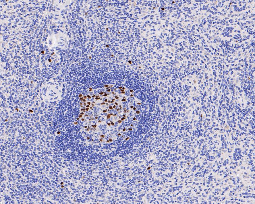 Immunohistochemical analysis of paraffin-embedded mouse colon tissue using anti-Phospho-Rb(S807) antibody. The section was pre-treated using heat mediated antigen retrieval with sodium citrate buffer (pH 6.0) for 20 minutes. The tissues were blocked in 5% BSA for 30 minutes at room temperature, washed with ddH2O and PBS, and then probed with the primary antibody (ET1602-36, 1/50)  for 30 minutes at room temperature. The detection was performed using an HRP conjugated compact polymer system. DAB was used as the chromogen. Tissues were counterstained with hematoxylin and mounted with DPX.