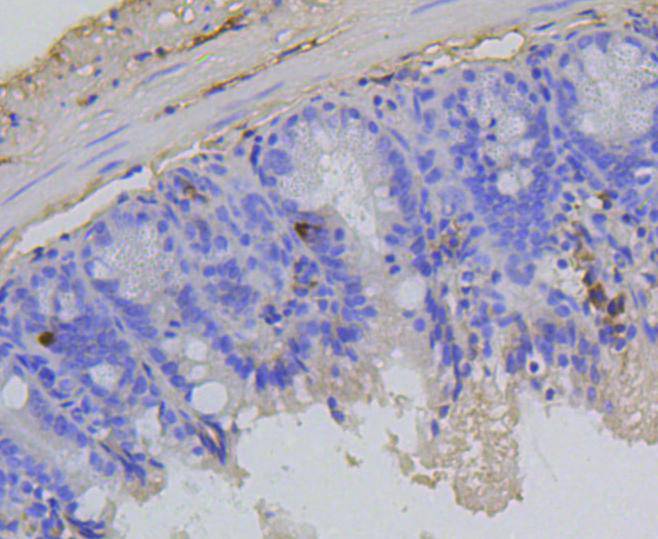 Immunohistochemical analysis of paraffin-embedded mouse spleen tissue using anti-Phospho-Rb(S807) antibody. The section was pre-treated using heat mediated antigen retrieval with sodium citrate buffer (pH 6.0) for 20 minutes. The tissues were blocked in 5% BSA for 30 minutes at room temperature, washed with ddH2O and PBS, and then probed with the primary antibody (ET1602-36, 1/50)  for 30 minutes at room temperature. The detection was performed using an HRP conjugated compact polymer system. DAB was used as the chromogen. Tissues were counterstained with hematoxylin and mounted with DPX.