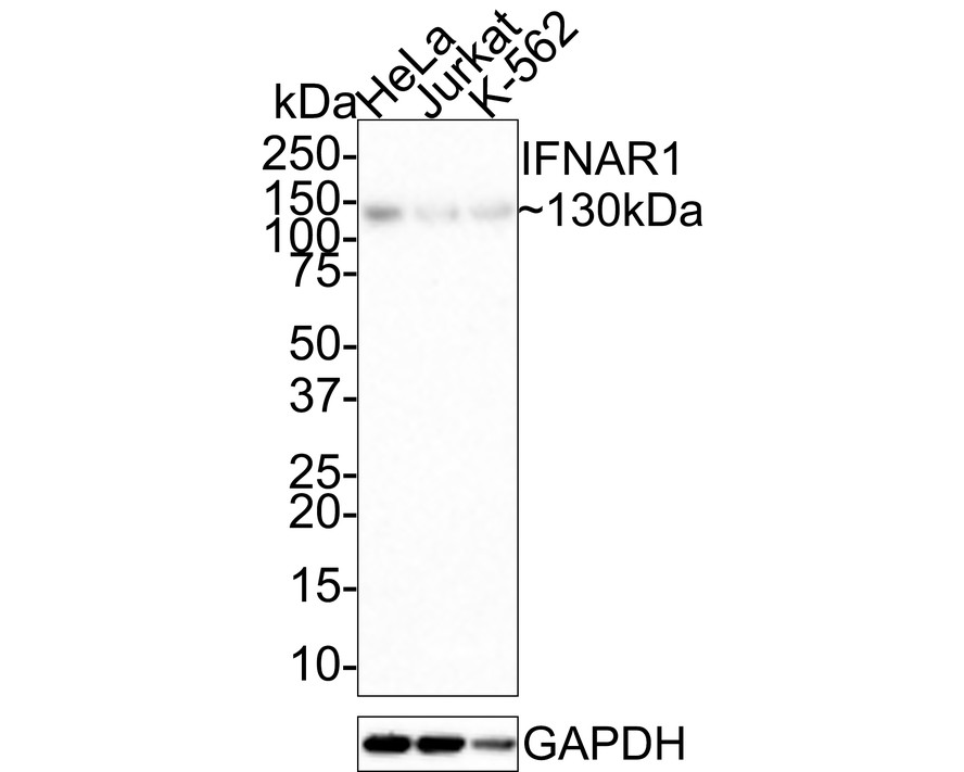 SiHa hücre lizatları üzerinde IFNAR1'in Western blot analizi.  Proteinler bir PVDF membranına aktarıldı ve oda sıcaklığında 1 saat boyunca PBS içinde %5 BSA ile bloke edildi.  Primer antikor (ET1602-37, 1/500), 2 saat boyunca oda sıcaklığında %5 BSA içinde kullanıldı.  Keçi Anti-Rabbit IgG - HRP Sekonder Antikoru (HA1001) 1:5,000 seyreltmede oda sıcaklığında 1 saat kullanıldı.