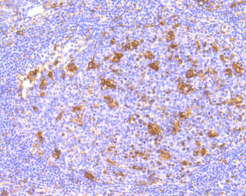 Immunohistochemical analysis of paraffin-embedded human tonsil tissue using anti-IFNAR1 antibody. The section was pre-treated using heat mediated antigen retrieval with Tris-EDTA buffer (pH 9.0) for 20 minutes.The tissues were blocked in 5% BSA for 30 minutes at room temperature, washed with ddH2O and PBS, and then probed with the primary antibody (ET1602-37, 1/50) for 30 minutes at room temperature. The detection was performed using an HRP conjugated compact polymer system. DAB was used as the chromogen. Tissues were counterstained with hematoxylin and mounted with DPX.