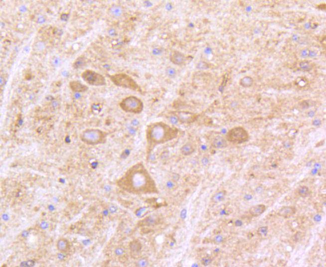 Immunohistochemical analysis of paraffin-embedded mouse brain tissue using anti-IFNAR1 antibody. The section was pre-treated using heat mediated antigen retrieval with Tris-EDTA buffer (pH 9.0) for 20 minutes.The tissues were blocked in 5% BSA for 30 minutes at room temperature, washed with ddH2O and PBS, and then probed with the primary antibody (ET1602-37, 1/50) for 30 minutes at room temperature. The detection was performed using an HRP conjugated compact polymer system. DAB was used as the chromogen. Tissues were counterstained with hematoxylin and mounted with DPX.