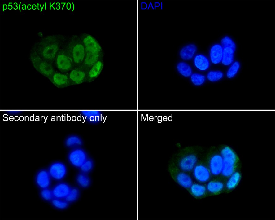 Immunocytochemistry analysis of MCF-7 cells labeling p53(acetyl K370) with Rabbit anti-p53(acetyl K370) antibody (ET1602-38) at 1/50 dilution.<br />
<br />
Cells were fixed in 4% paraformaldehyde for 10 minutes at 37 ℃, permeabilized with 0.05% Triton X-100 in PBS for 20 minutes, and then blocked with 2% negative goat serum for 30 minutes at room temperature. Cells were then incubated with Rabbit anti-p53(acetyl K370) antibody (ET1602-38) at 1/50 dilution in 2% negative goat serum overnight at 4 ℃. Goat Anti-Rabbit IgG H&L (iFluor™ 488, HA1121) was used as the secondary antibody at 1/1,000 dilution. PBS instead of the primary antibody was used as the secondary antibody only control. Nuclear DNA was labelled in blue with DAPI.