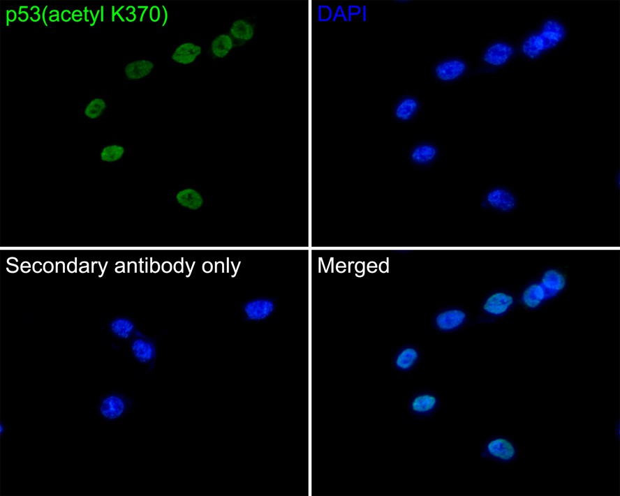 Immunocytochemistry analysis of PANC-1 cells labeling p53(acetyl K370) with Rabbit anti-p53(acetyl K370) antibody (ET1602-38) at 1/50 dilution.<br />
<br />
Cells were fixed in 4% paraformaldehyde for 10 minutes at 37 ℃, permeabilized with 0.05% Triton X-100 in PBS for 20 minutes, and then blocked with 2% negative goat serum for 30 minutes at room temperature. Cells were then incubated with Rabbit anti-p53(acetyl K370) antibody (ET1602-38) at 1/50 dilution in 2% negative goat serum overnight at 4 ℃. Goat Anti-Rabbit IgG H&L (iFluor™ 488, HA1121) was used as the secondary antibody at 1/1,000 dilution. PBS instead of the primary antibody was used as the secondary antibody only control. Nuclear DNA was labelled in blue with DAPI.