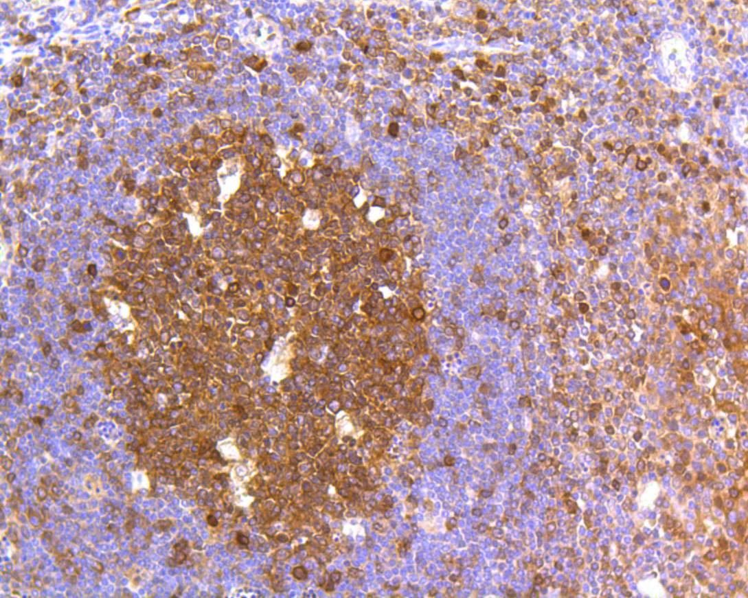 Immunohistochemical analysis of paraffin-embedded human tonsil tissue using anti-Caspase-3 antibody. The section was pre-treated using heat mediated antigen retrieval with Tris-EDTA buffer (pH 8.0-8.4) for 20 minutes.The tissues were blocked in 5% BSA for 30 minutes at room temperature, washed with ddH2O and PBS, and then probed with the primary antibody (ET1602-39, 1/50) for 30 minutes at room temperature. The detection was performed using an HRP conjugated compact polymer system. DAB was used as the chromogen. Tissues were counterstained with hematoxylin and mounted with DPX.