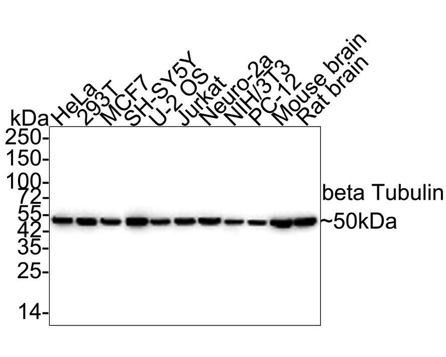 Farklı lizatlar üzerinde beta Tubulin'in Western blot analizi.  Proteinler bir PVDF membranına aktarıldı ve oda sıcaklığında 1 saat boyunca PBS içinde %5 BSA ile bloke edildi.  Birincil antikor (ET1602-4, 1/500), 2 saat boyunca oda sıcaklığında %5 BSA içinde kullanıldı.  Keçi Anti-Rabbit IgG - HRP Sekonder Antikoru (HA1001) 1:5,000 seyreltmede oda sıcaklığında 1 saat kullanıldı.  Pozitif kontrol: Şerit 1: A431 hücre lizatı Şerit 2: MCF-7 hücre lizatı Şerit 3: SH-SY5Y hücre lizatı Şerit 4: fare beyin dokusu lizatı Şerit 5: Hela hücre lizatı Şerit 6: NIH/3T3 hücre lizatı Şerit 7: PC -12 hücre lizatı