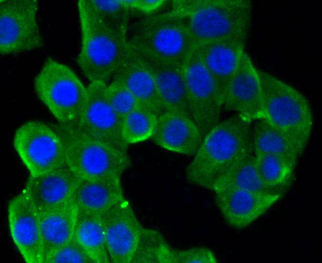 ICC staining of beta Tubulin in CRC cells (green). Formalin fixed cells were permeabilized with 0.1% Triton X-100 in TBS for 10 minutes at room temperature and blocked with 10% negative goat serum for 15 minutes at room temperature. Cells were probed with the primary antibody (ET1602-4, 1/50) for 1 hour at room temperature, washed with PBS. Alexa Fluor®488 conjugate-Goat anti-Rabbit IgG was used as the secondary antibody at 1/1,000 dilution. The nuclear counter stain is DAPI (blue).