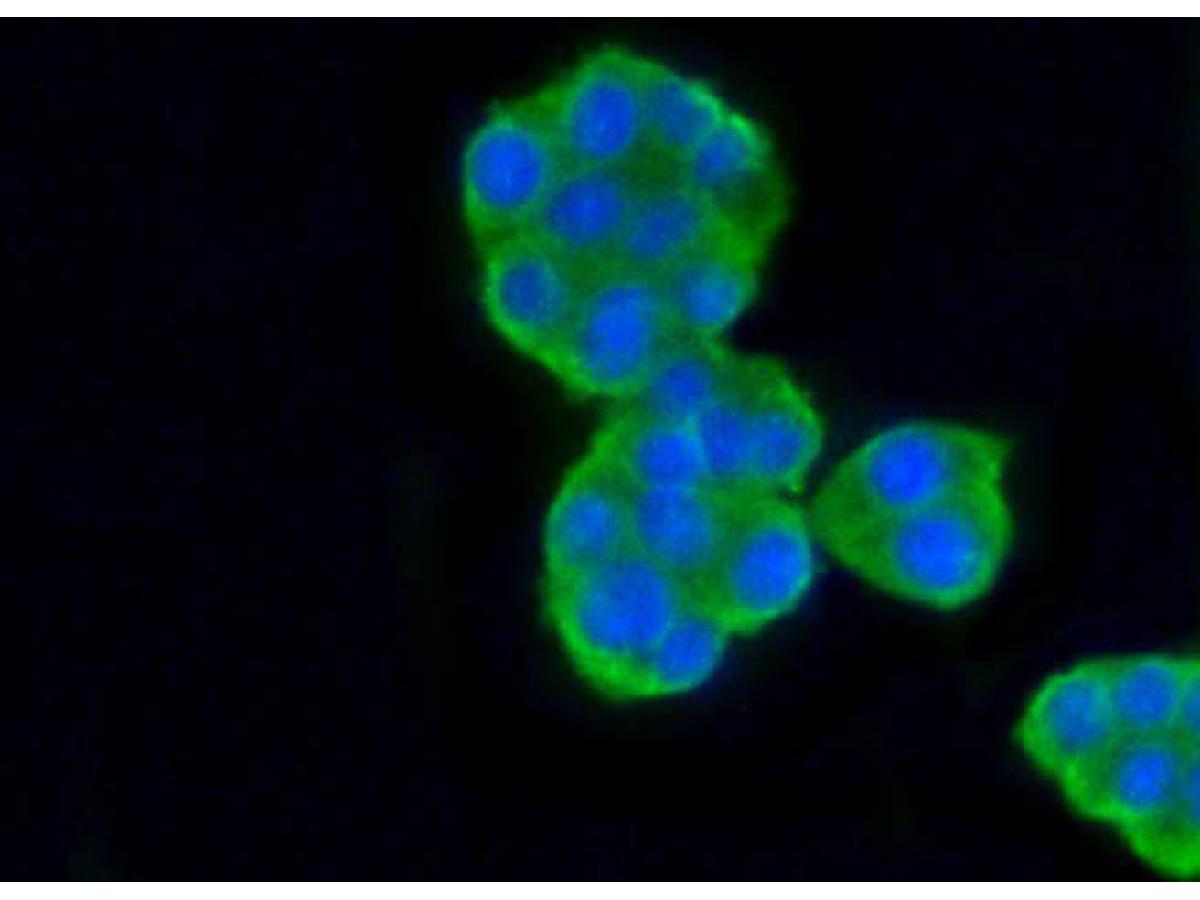 ICC staining of beta Tubulin in SH-SY5Y cells (green). Formalin fixed cells were permeabilized with 0.1% Triton X-100 in TBS for 10 minutes at room temperature and blocked with 10% negative goat serum for 15 minutes at room temperature. Cells were probed with the primary antibody (ET1602-4, 1/50) for 1 hour at room temperature, washed with PBS. Alexa Fluor®488 conjugate-Goat anti-Rabbit IgG was used as the secondary antibody at 1/1,000 dilution. The nuclear counter stain is DAPI (blue).